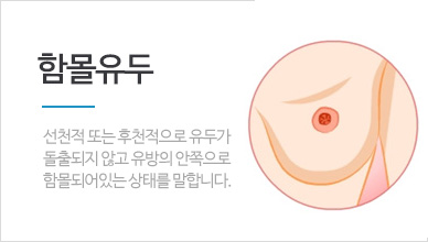 함몰유두