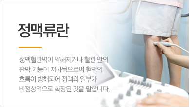 정맥류란